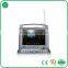 Full-digital Color Doppler Ultrasound cardiac 3D doppler ultrasound