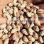 2015 crop Light Speckled Kidney Beans, LSKB , 220-240pcs