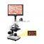 HC-R069 Hot sale Veterinary insemination instrument 7 inch Microscope/ Biological Microscope animal  sperm analysis observation
