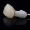 Denture false teeth CAD/CAM Design dental laboratory dental restorations dental Implant Restorations