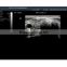 Panoramic focusing technology Laptop Ultrasound Machine Price for sale- BPU06
