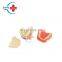 HC-S417 factory wholesale Dental high simulation Dental model human teeth model for studying
