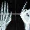 HOT selling thermal dry medical x-ray film /medical x-ray film agfa with CE hot film asia blue