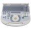 Cheap price portable ultrasound scanner with 3.5Mhz convex probe manufacturer