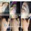 2000mj q switch nd yag laser tattoo removal machine for birthmark/keyword:nd yag laser