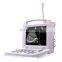 MY-A005 B Ultrasound Diagnostic System Hospital cheapest portable ultrasound machine