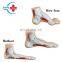 HC-S274 Normal foot/flat foot/arched foot model,Medical Human Anatomical foot model