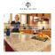Creative design kitchen marble granite countertops