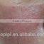 Skin Resurfacing Acne Scar Removal Treatment CO2 Multifunctional Fractional Laser Machine POP IPL FC10
