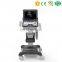 MY-A039A color doppler ultrasound price portable ultrasound machine