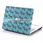 variety laptop plastic case for mac book pro 13 retina case