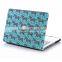 general plastics hard case for laptop macbook