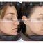 2015Newest products facial skin analyzer for wrinkle analysis