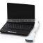 3D workstaion 10 inch Laptop Ultrasound machine RUS-9000F with 3.5Mhz Convex probe
