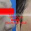 Skin Regeneration Beauty Fractional CO2 Laser Equipment 8.0 Inch 100um-2000um Fractional Laser Skin Treatment Machine Skin Renewing