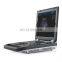 MY-A024F medical machines laptop ultrasound color doppler full digital portable ultrasound for sale