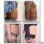 Multifunction ultrasonic liposuction cavitation machine for sale, weight loss radio frequency machine (CE Approved)