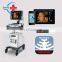 Hot sale extensive use Mindray color doppler ultrasound /Mindray dc 30 /Mindray