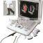 MC-DU-Q8 Portable OB/GYN 3D/4D Cardiac Color Doppler Ultrasound Scanner