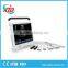 Touch Screen 15 inch Display Portable Ultrasound with good price