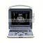 2016 new type 3d/4d ultrasound color doppler syatem for sale