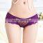 OEM or ODM 2016 hot sex open back sexy underwear