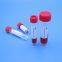 Factory Wholesale Disposable Virus Sampling VTM Kits with Nasopharyngeal or Oropharyngeal Swabs