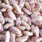 China light speckelkidney beans with high quality for sale