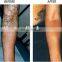 Switch ND YAG Laser price/tatto removal machine/ q swithed laser