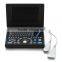 Cardiac Urology Measurement laptop Ultrasound Scanner for convex linear micro-convex transvaginal rectal probe option