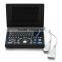 RUS-9000E2 Full Digital Laptop Ultrasound Scanner with high quality