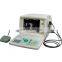 YODM-2100 Ultrasound A/B Scanner for Ophthalmology