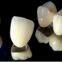 REMOVABLES | PARTIALS  CustomFlex Flexible Partial Dental Lab