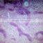 Fibrous hyperplasia of bone sec. oral histology pathology parasitology prepared slides