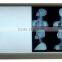 Coupon available! Double medical x ray view box with LED light, high quality (MSLXF11-N)