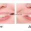 Innovation 10ml Gel, Mint Flavor Teeth Whitening Gel