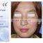 Eliminate Body Odor Z15B CO2 Fractional Treat 10600nm Telangiectasis Laser Scar Removal Machine Birth Mark Removal