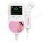 Fetal Doppler  SonoTech Pro