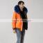 New trendy comfortable khaki and orange revisible warm men down jacket