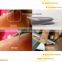 2014 Newest Hot Sale 30Mhz Professional Blood Vessel Removal Device