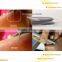 Painless High Frequency Facial Vascular Lesion Removal Beauty Machine
