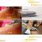 2014 Newest Hot Sale 30Mhz Professional Blood Vessel Removal Device