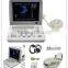 Good price Full Digital Portable Ultrasound Scanner RUS-6000D with linear transvaginal convex microconvex probe