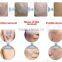 Newest!!! Doctor Use Q switch Nd Yag Laser Tattoo Removal machine