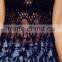 Misread Lace Top Women Fashion Dress