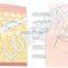 Liposuction machines surgical cellulite removal for body slimming