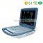 Direct Sale Medical Ecograph Laptop notebook Portable Color Doppler Ultrasound Scanner