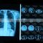hot blue film fuji medical x-ray film blue films in tamil