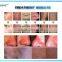 Painless and effective removal spider vein portable laser equipment for spider veins