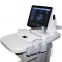 Sonostar Portable Ultrasound Color Doppler Low Prices Of Ultrasound Machine